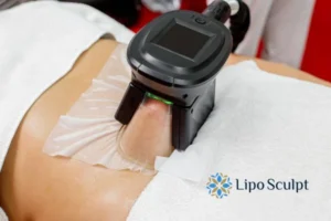 Cryolipolysis Helping You Getting that Perfect Summer Body 3 Cryolipolysis Ripley can give you the best summer body - contact us today!