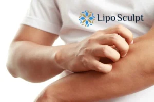 Best Actinic Keratoses Removal 4 prevent your actinic keratoses Ripley getting worse - call our team today!
