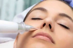Best Actinic Keratoses Removal 3 Actinic keratoses Ripley solutions - book in today!