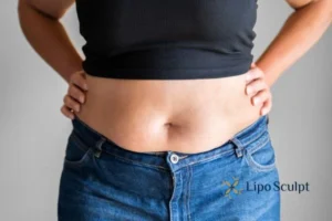 Bidding Farewell to Muffin Tops with Aqualyx Fat Injections 2 Do you wish you could reduce your muffin top Ripley With Aqualy fat dissolving injections you can!